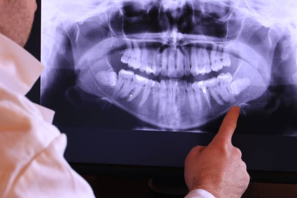 Best Emergency Gum Treatment in Norway, MI