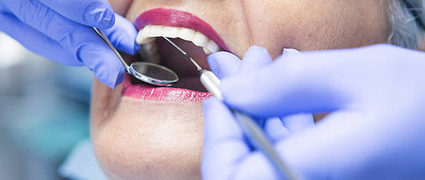 Best Emergency Dental Care for Broken or Chipped Teeth in Norway, MI